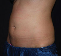After Image