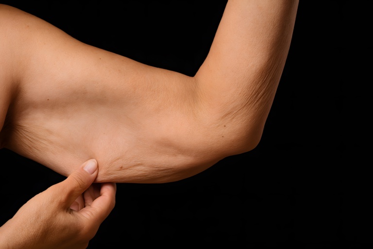 how to avoid loose skin when losing weight on glp-1 How Can I Tighten My Skin After Weight Loss with GLP-1 Medications?